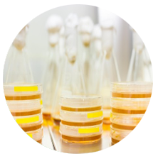 배양 이미지 자리